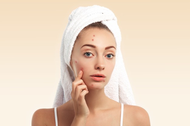 5 Acne Patch untuk Atasi Jerawat Tanpa Ganggu Penampilan
