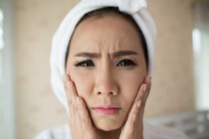 Ini Penyebab Kulit Wajah Berminyak dan Cara Mengatasinya