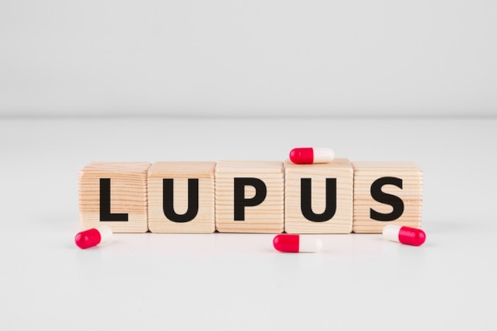 Waspadai 8 Gejala Awal Lupus pada Anak dan Remaja