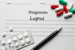 Hari Lupus Sedunia, Ini 5 Fakta Seputar Penyakit Lupus