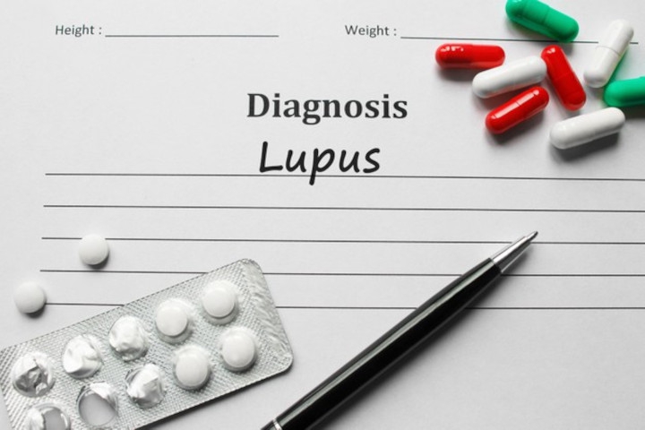 Hari Lupus Sedunia, Ini 5 Fakta Seputar Penyakit Lupus