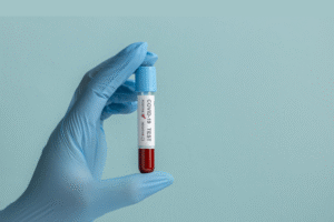 Deteksi Dini Keganasan Darah dengan Teknologi Digital Morphology Analyzer