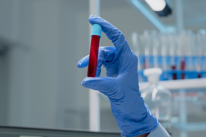 8 Penyakit Keturunan yang Sulit Dihindari