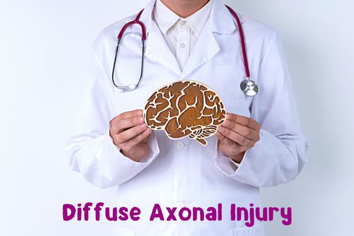 Mengenal Cedera Otak Diffuse Axonal Injury (DAI), Bisa Sembuh Lagi?